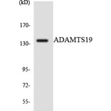 Western Blot - Anti-ADAMTS19 Antibody (R12-2445) - Antibodies.com