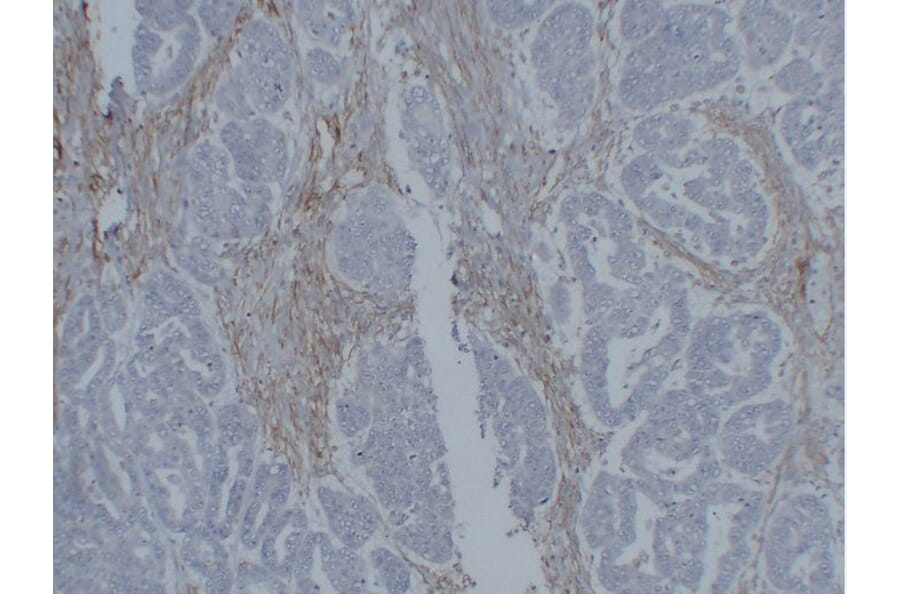 Immunohistochemistry - Anti-Vimentin Antibody (V0139) - Antibodies.com