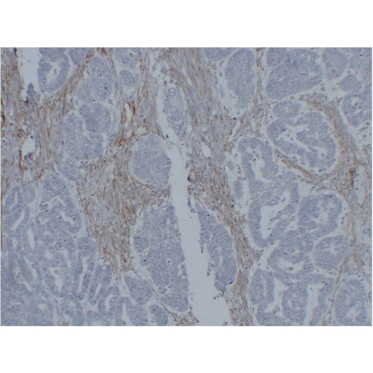 Immunohistochemistry - Anti-Vimentin Antibody (V0139) - Antibodies.com