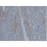 Immunohistochemistry - Anti-Vimentin Antibody (V0139) - Antibodies.com