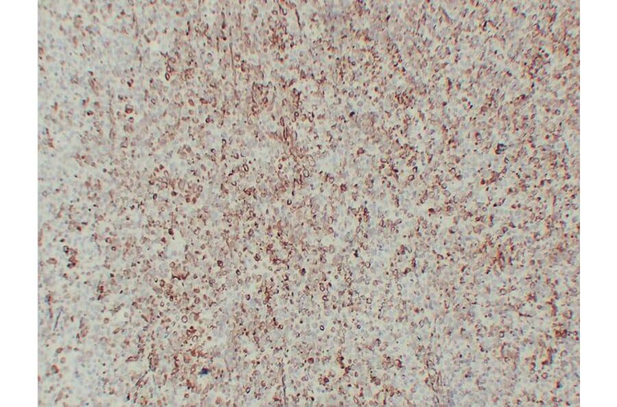 Immunohistochemistry - Anti-Vimentin Antibody (V0139) - Antibodies.com