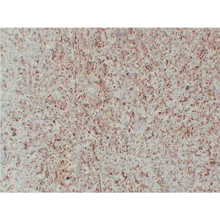 Immunohistochemistry - Anti-Vimentin Antibody (V0139) - Antibodies.com