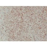 Immunohistochemistry - Anti-Vimentin Antibody (V0139) - Antibodies.com