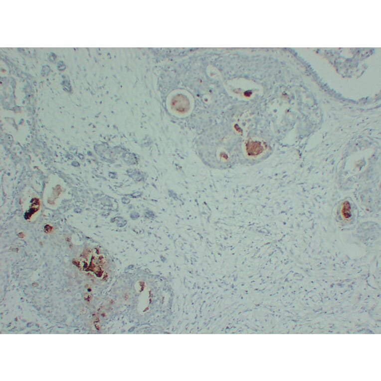 Immunohistochemistry - Anti-GCDFP 15 Antibody (V0075) - Antibodies.com