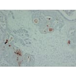 Immunohistochemistry - Anti-GCDFP 15 Antibody (V0075) - Antibodies.com
