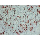 Immunohistochemistry - Anti-GCDFP 15 Antibody (V0075) - Antibodies.com