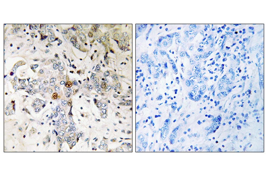 Immunohistochemistry - Anti-ZCCHC17 Antibody (C17167) - Antibodies.com