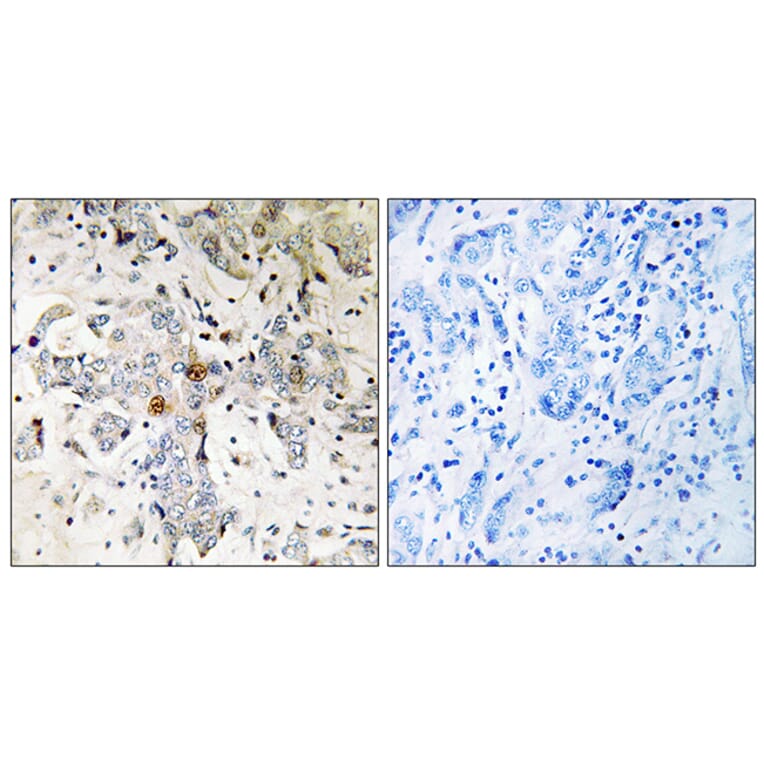 Immunohistochemistry - Anti-ZCCHC17 Antibody (C17167) - Antibodies.com