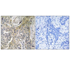 Immunohistochemistry - Anti-RHOBTB3 Antibody (C18407) - Antibodies.com