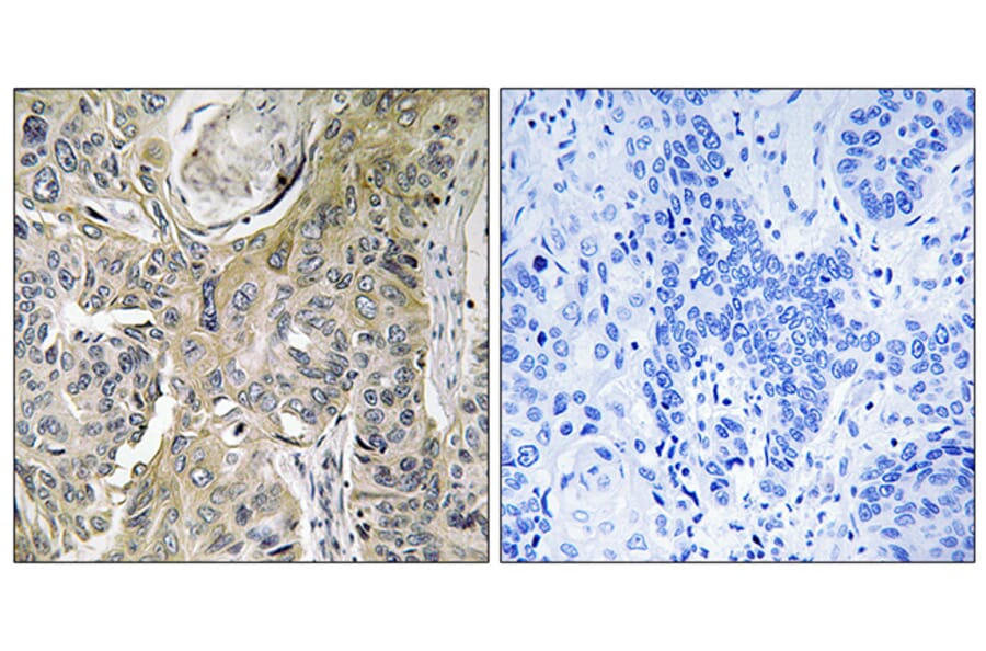 Immunohistochemistry - Anti-RHOBTB3 Antibody (C18407) - Antibodies.com