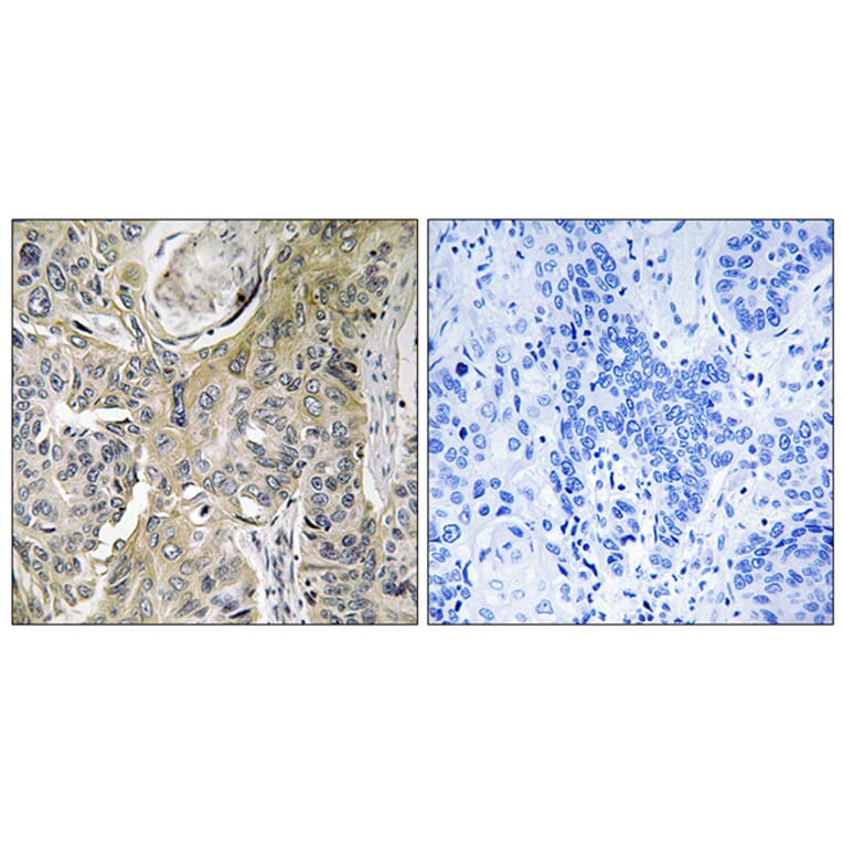 Immunohistochemistry - Anti-RHOBTB3 Antibody (C18407) - Antibodies.com