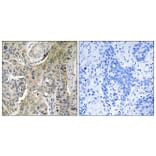 Immunohistochemistry - Anti-RHOBTB3 Antibody (C18407) - Antibodies.com