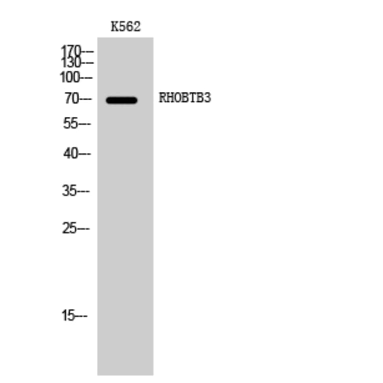 Western Blot - Anti-RHOBTB3 Antibody (C18407) - Antibodies.com