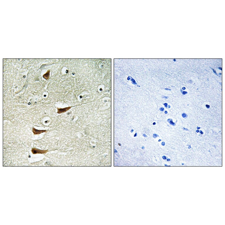 Immunohistochemistry - Anti-MAP3K10 Antibody (C10857) - Antibodies.com
