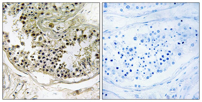 Immunohistochemical analysis of paraffin-embedded human testis tissue using Anti-DYNLRB2 Antibody. The right hand panel represents a negative control, where the antibody was pre-incubated with the immunising peptide.