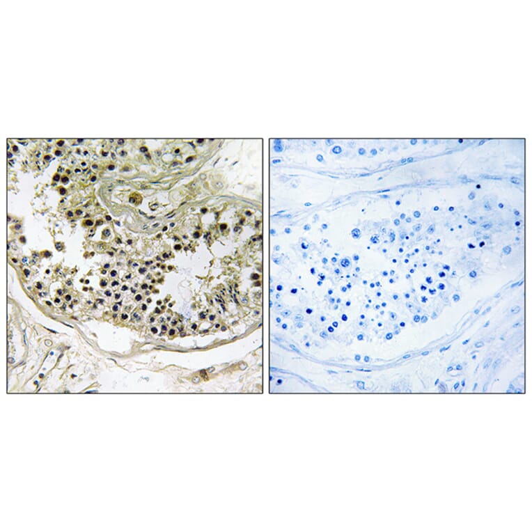 Immunohistochemistry - Anti-DYNLRB2 Antibody (C15517) - Antibodies.com