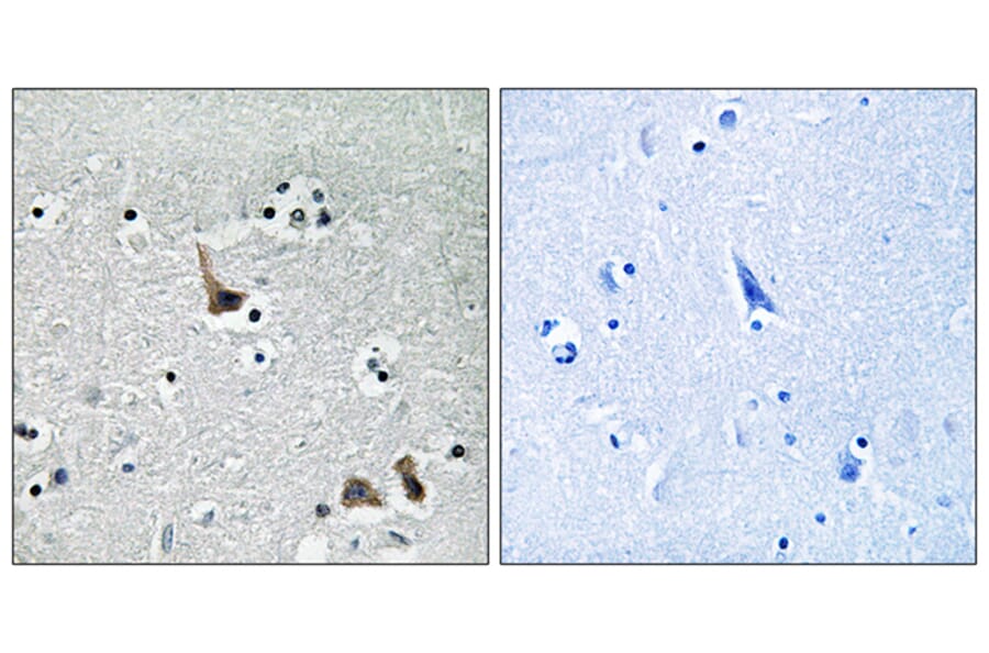 Immunohistochemistry - Anti-ATP6V1H Antibody (C19484) - Antibodies.com