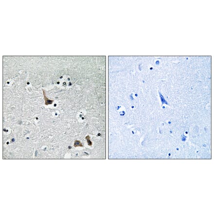Immunohistochemistry - Anti-ATP6V1H Antibody (C19484) - Antibodies.com