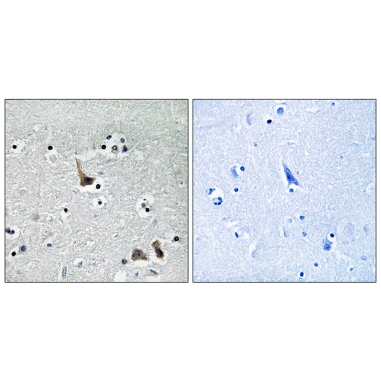Immunohistochemistry - Anti-ATP6V1H Antibody (C19484) - Antibodies.com