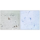 Immunohistochemistry - Anti-ATP6V1H Antibody (C19484) - Antibodies.com