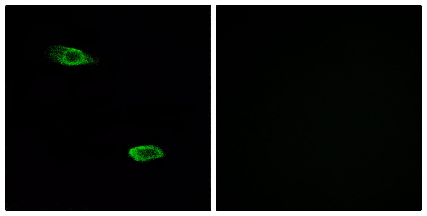 Immunofluorescence analysis of A549 cells using Anti-OR51E2 Antibody. The right hand panel represents a negative control, where the antibody was pre-incubated with the immunising peptide.