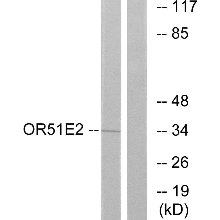 Western Blot - Anti-OR51E2 Antibody (G447) - Antibodies.com