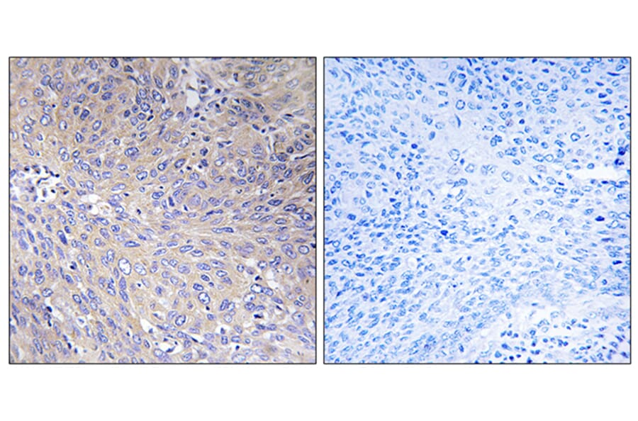 Immunohistochemistry - Anti-MRPL11 Antibody (C14055) - Antibodies.com