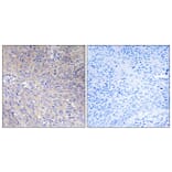 Immunohistochemistry - Anti-MRPL11 Antibody (C14055) - Antibodies.com