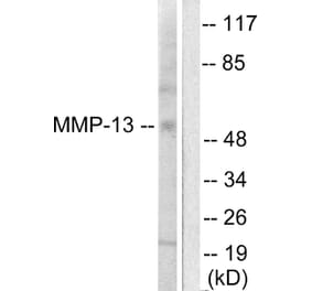 Western Blot - Anti-MMP-13 Antibody (C0265) - Antibodies.com