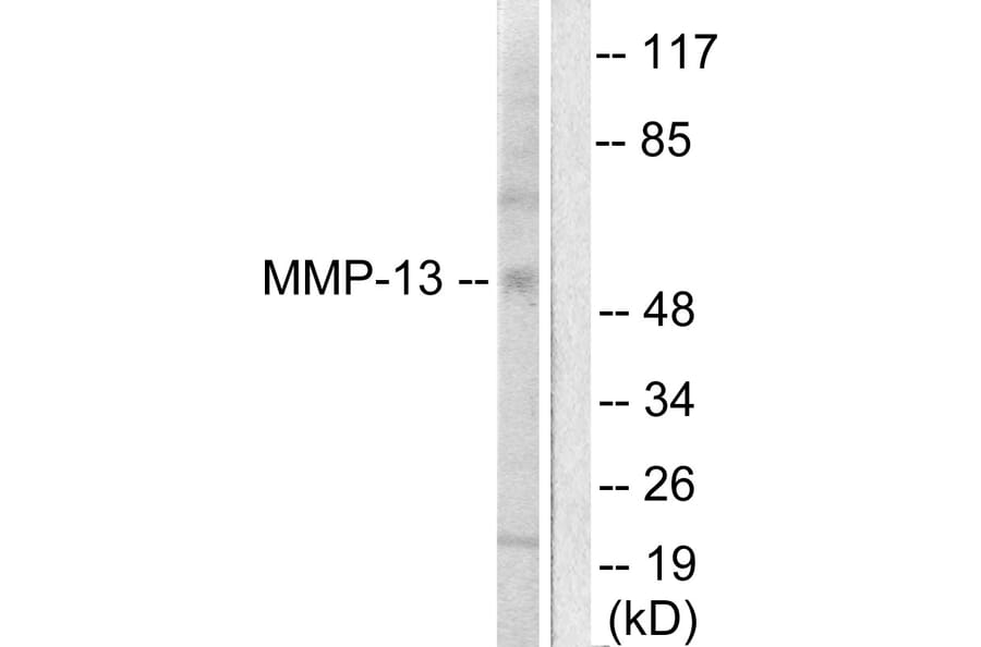 Western Blot - Anti-MMP-13 Antibody (C0265) - Antibodies.com