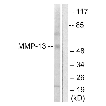 Western Blot - Anti-MMP-13 Antibody (C0265) - Antibodies.com