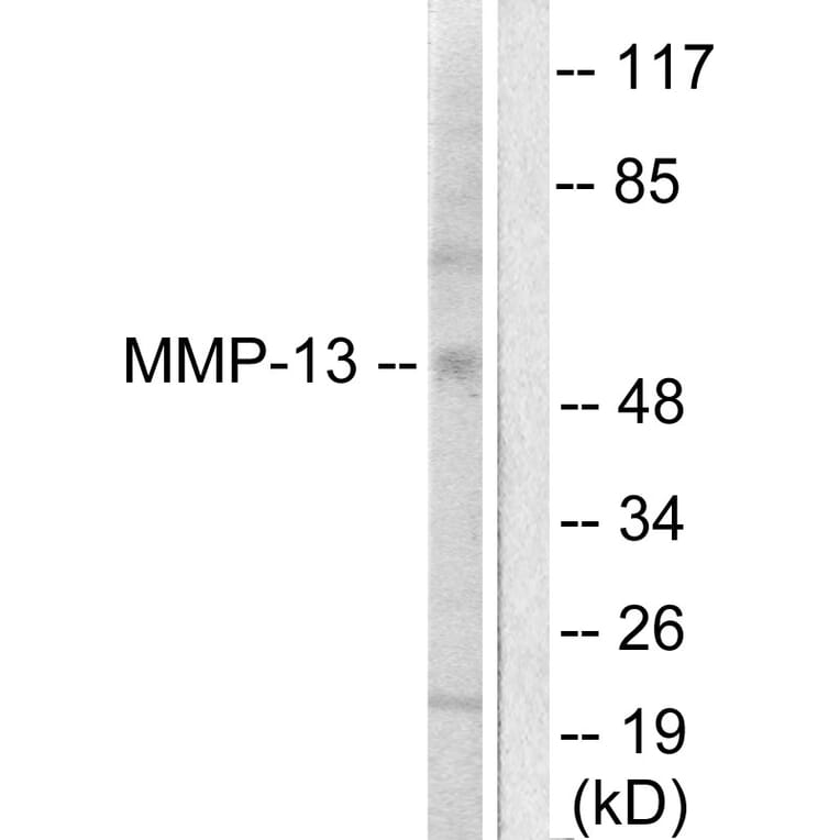 Western Blot - Anti-MMP-13 Antibody (C0265) - Antibodies.com