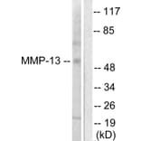 Western Blot - Anti-MMP-13 Antibody (C0265) - Antibodies.com
