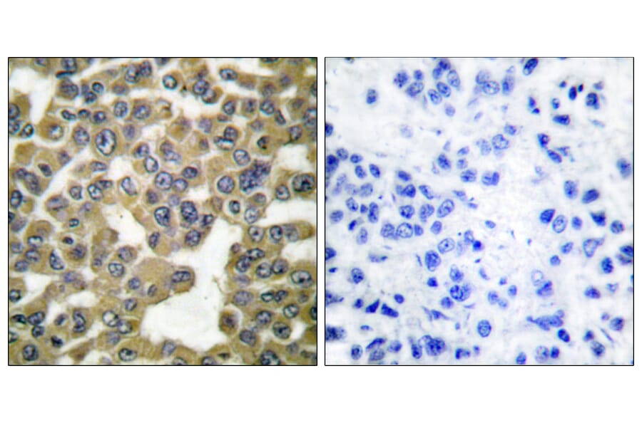 Immunohistochemistry - Anti-MMP-13 Antibody (C0265) - Antibodies.com