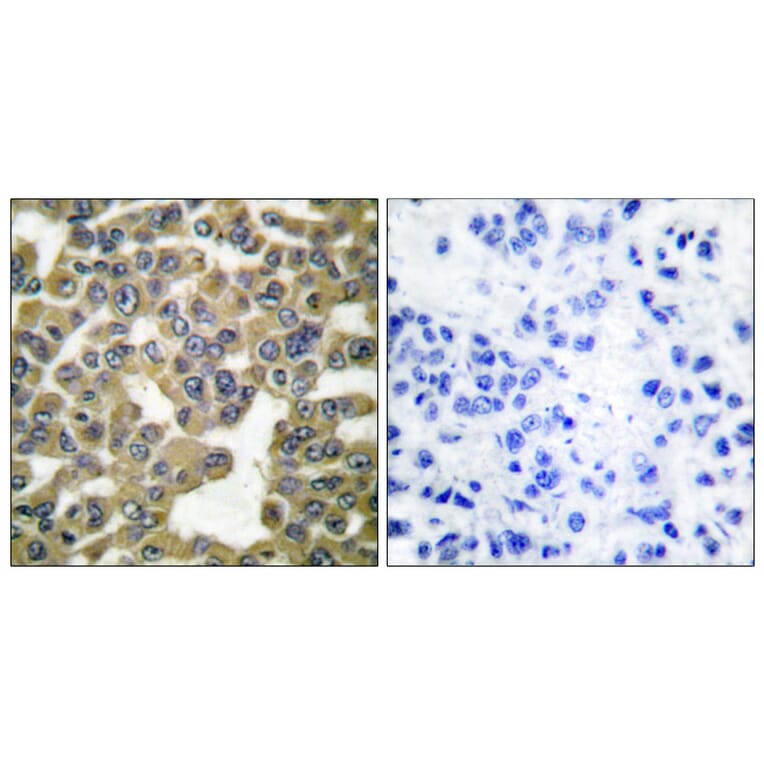 Immunohistochemistry - Anti-MMP-13 Antibody (C0265) - Antibodies.com