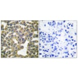Immunohistochemistry - Anti-MMP-13 Antibody (C0265) - Antibodies.com