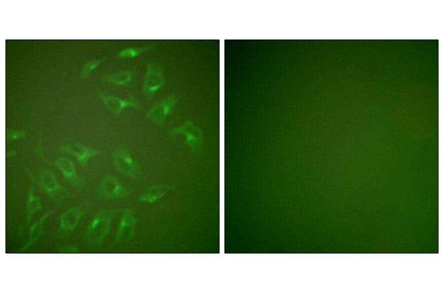 Immunofluorescence - Anti-MMP-13 Antibody (C0265) - Antibodies.com