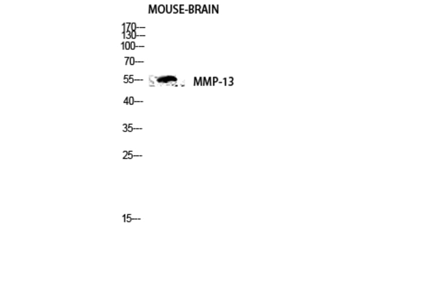 Western Blot - Anti-MMP-13 Antibody (C0265) - Antibodies.com