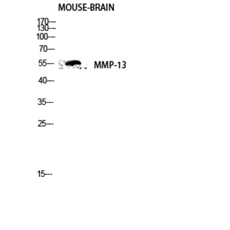 Western Blot - Anti-MMP-13 Antibody (C0265) - Antibodies.com