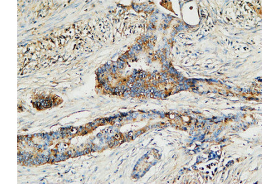 Immunohistochemistry - Anti-MMP-13 Antibody (C0265) - Antibodies.com