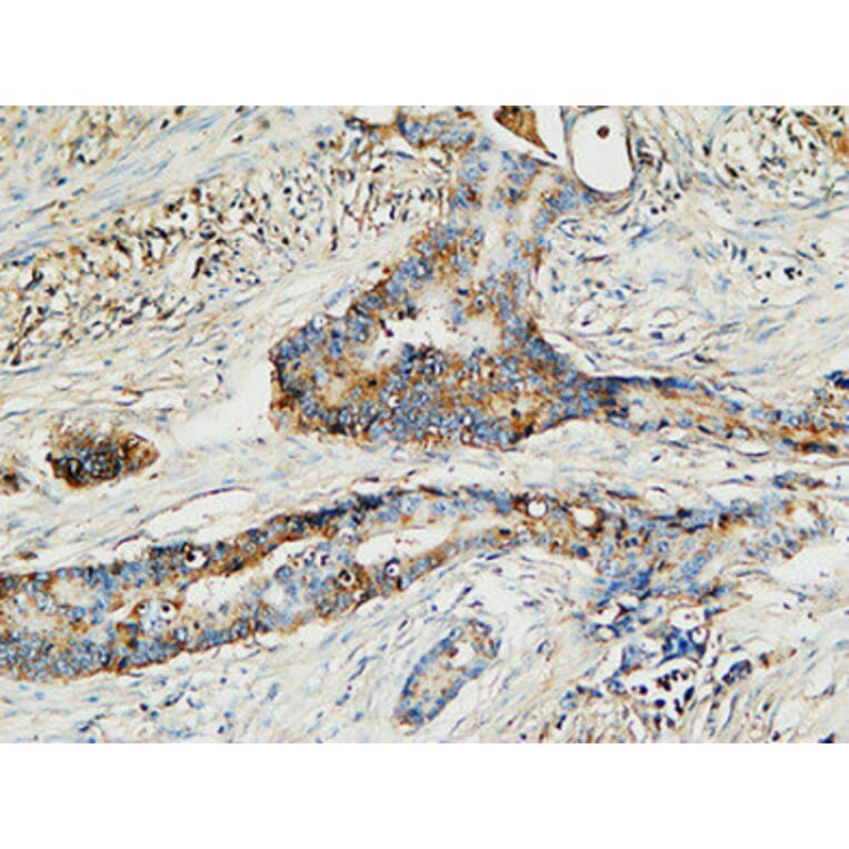 Immunohistochemistry - Anti-MMP-13 Antibody (C0265) - Antibodies.com