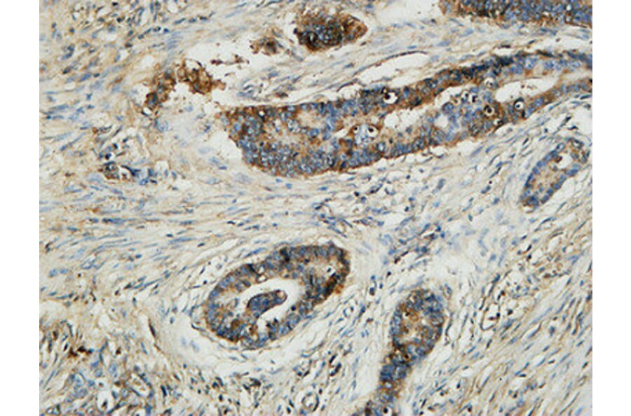 Immunohistochemistry - Anti-MMP-13 Antibody (C0265) - Antibodies.com