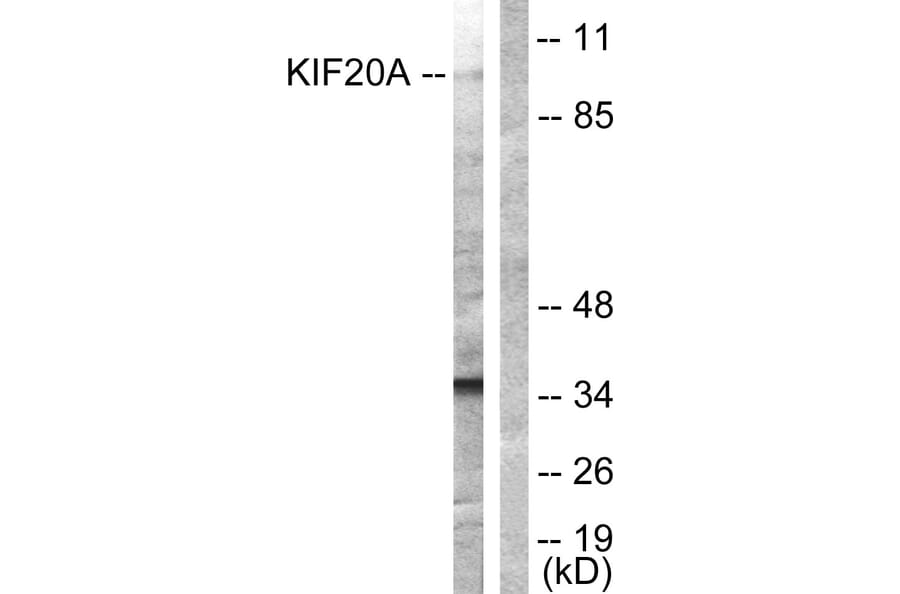 Western Blot - Anti-KIF20A Antibody (B1082) - Antibodies.com
