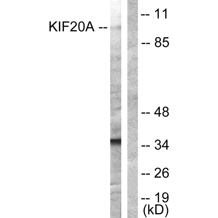 Western Blot - Anti-KIF20A Antibody (B1082) - Antibodies.com