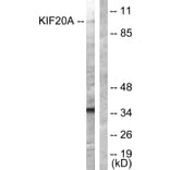 Western Blot - Anti-KIF20A Antibody (B1082) - Antibodies.com