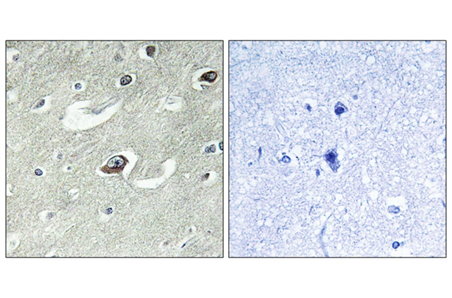 Immunohistochemistry - Anti-KIF20A Antibody (B1082) - Antibodies.com