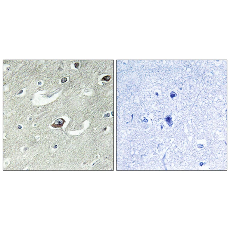 Immunohistochemistry - Anti-KIF20A Antibody (B1082) - Antibodies.com