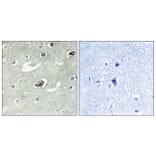 Immunohistochemistry - Anti-KIF20A Antibody (B1082) - Antibodies.com