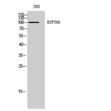 Western Blot - Anti-KIF20A Antibody (B1082) - Antibodies.com