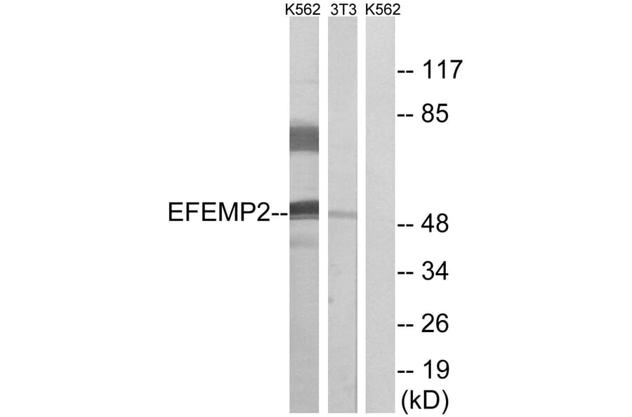 Western Blot - Anti-EFEMP2 Antibody (C15602) - Antibodies.com